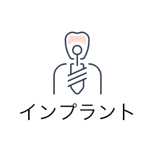 インプラント